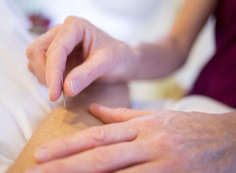 The Evolution & Significance of Acupuncture in the USA: A Closer Look at Acupuncture and Herbal Medicine Day